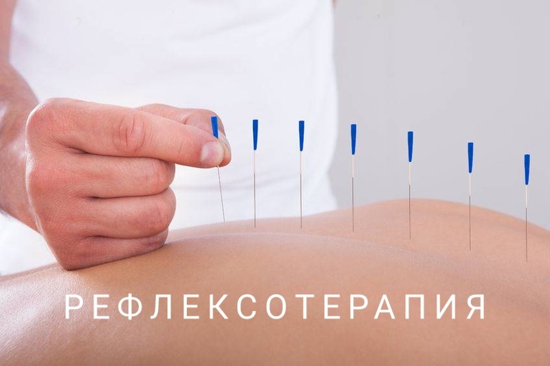 Рефлексотерапия Рефлексотерапия