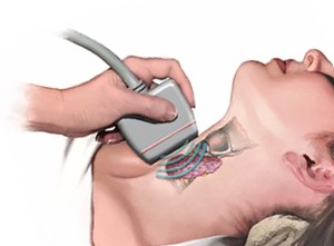 УЗИ щитовидной железы